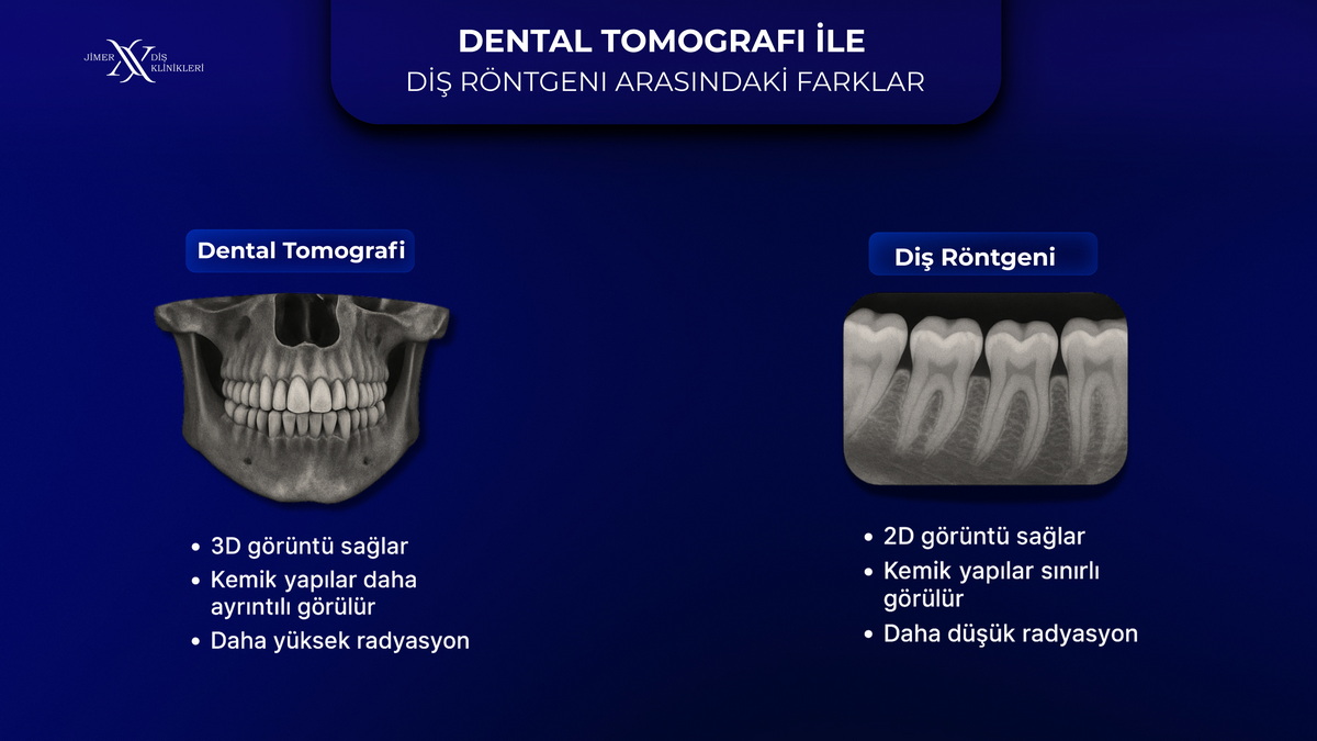Volümetrik Dental Tomografi ve Panoramik Röntgen Nedir? Volümetrik Dental Tomografi ve Panoramik Röntgen Nedir?